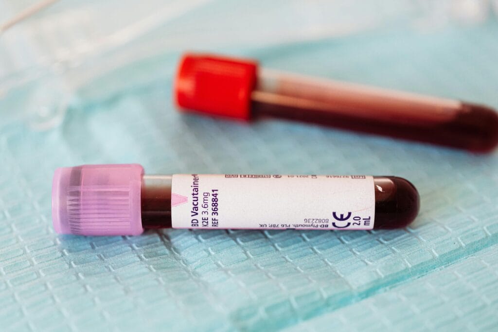 Blood donations 